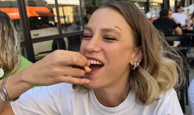 Serenay Sarıkaya hayranlarını korkuttu! ''Kaşımdaki yara...''